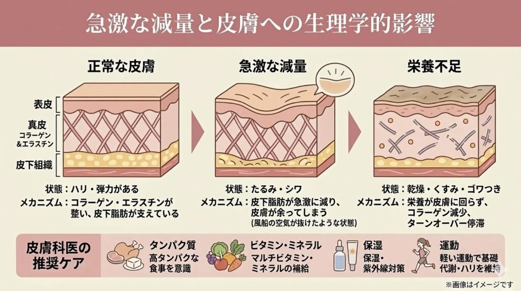 激な減量と皮膚への生理学的影響の解説図。「正常な皮膚」「急激な減量(たるみ・シワ)」「栄養不足(乾燥・くすみ)」の肌断面のメカニズム比較と、下部に皮膚科医が推奨するケア(高タンパクな食事、マルチビタミン、保湿・紫外線対策、軽い運動)がまとめられた画像